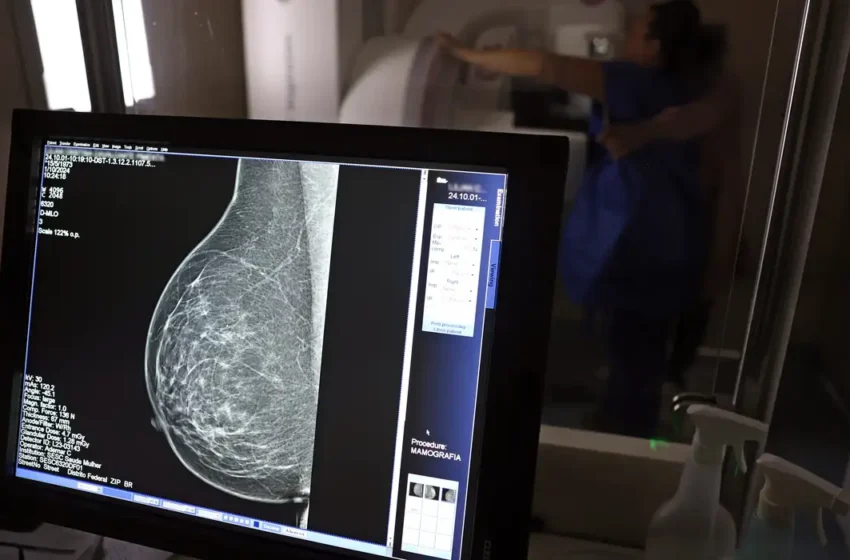  Câncer de mama não é só depois dos 50: histórias de mulheres jovens que enfrentam a doença