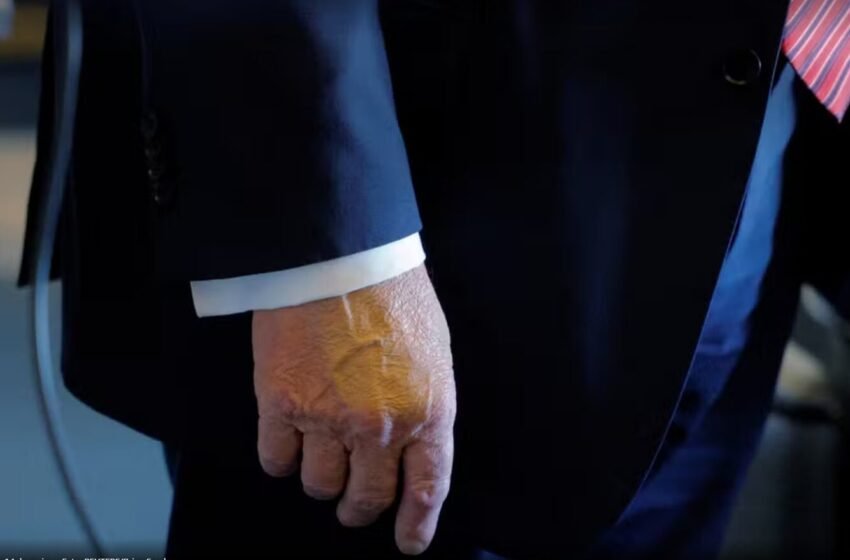  Trump exibe mão maquiada em reaparição pública após problemas circulatórios